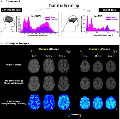 Human-to-monkey transfer learning identifies the frontal white matter as a key determinant for predicting monkey brain age